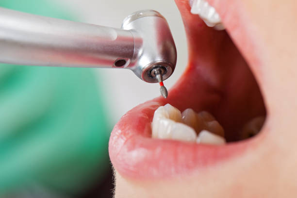 Best Emergency Dental Care for Broken or Chipped Teeth in Stratford, WI